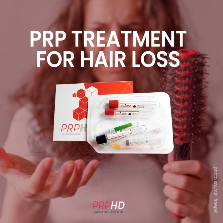 Say Goodbye to Hair Loss with PRPHD